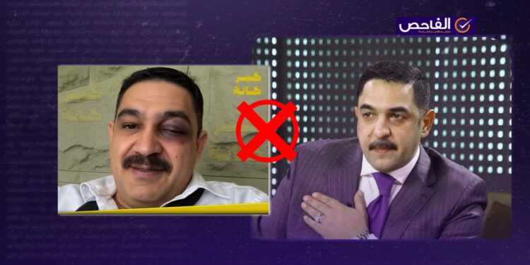 الصورة مفبركة ولا تظهر كدمات على عين النائب الدهلكي بعد مشاجرة البرلمان!